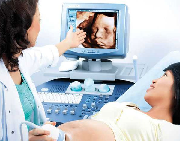 Sonography
